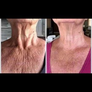 Cellulite Contouring Cream